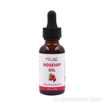 Huile essentielle du corps des graines de rosehip biologique